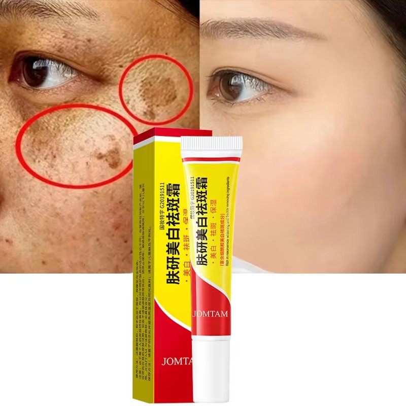 화이트닝 주근깨 크림 페이스 브라이트닝 크림 나이아신아 - Skincare Glad2Glow 리뷰 및 가격