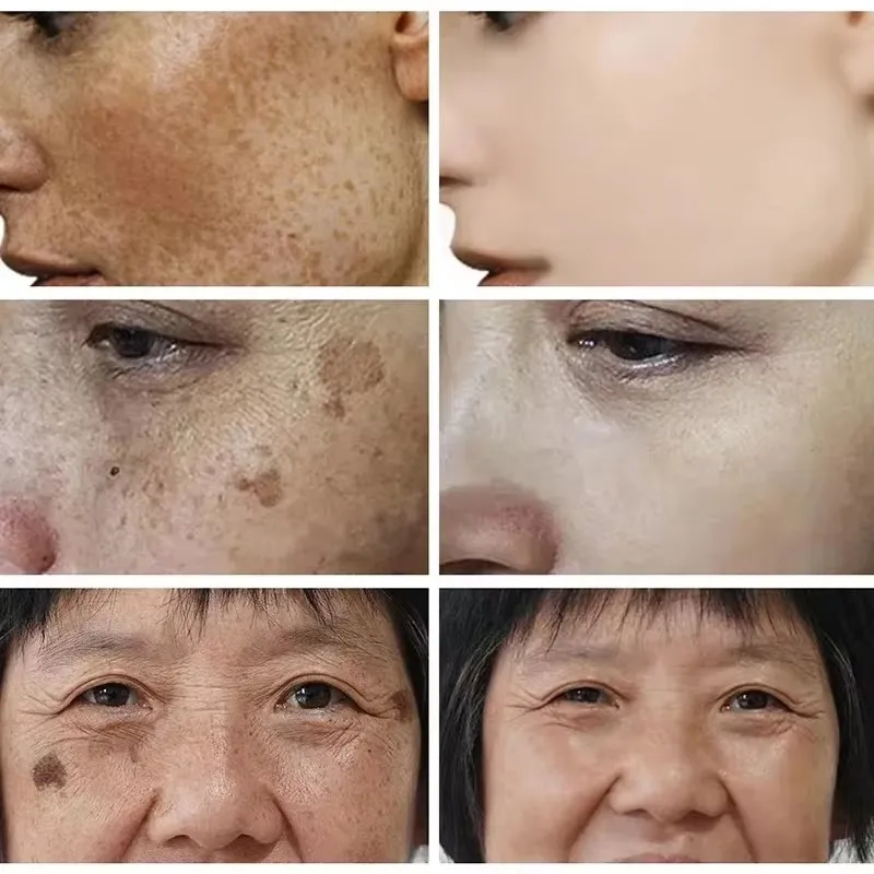 화이트닝 주근깨 크림 페이스 브라이트닝 크림 나이아신아 - Skincare Glad2Glow 리뷰 및 가격